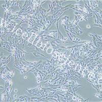 SW756 人子宫鳞状癌细胞 | SW-756细胞 | SW-756 | SW756细胞 | SW756 | STR鉴定