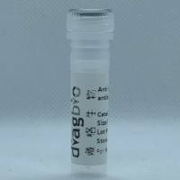 ATF2 Recombinant Rabbit mAb