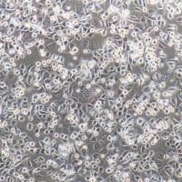 AGS人胃腺癌细胞/STR鉴定细胞/中科院、ATCC专业引进