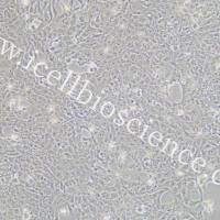 4T1+GFP 小鼠乳腺癌细胞绿色荧光标记/STR鉴定