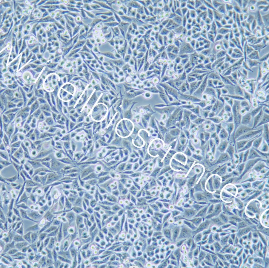 Calu-6 人肺退行性癌细胞/STR鉴定