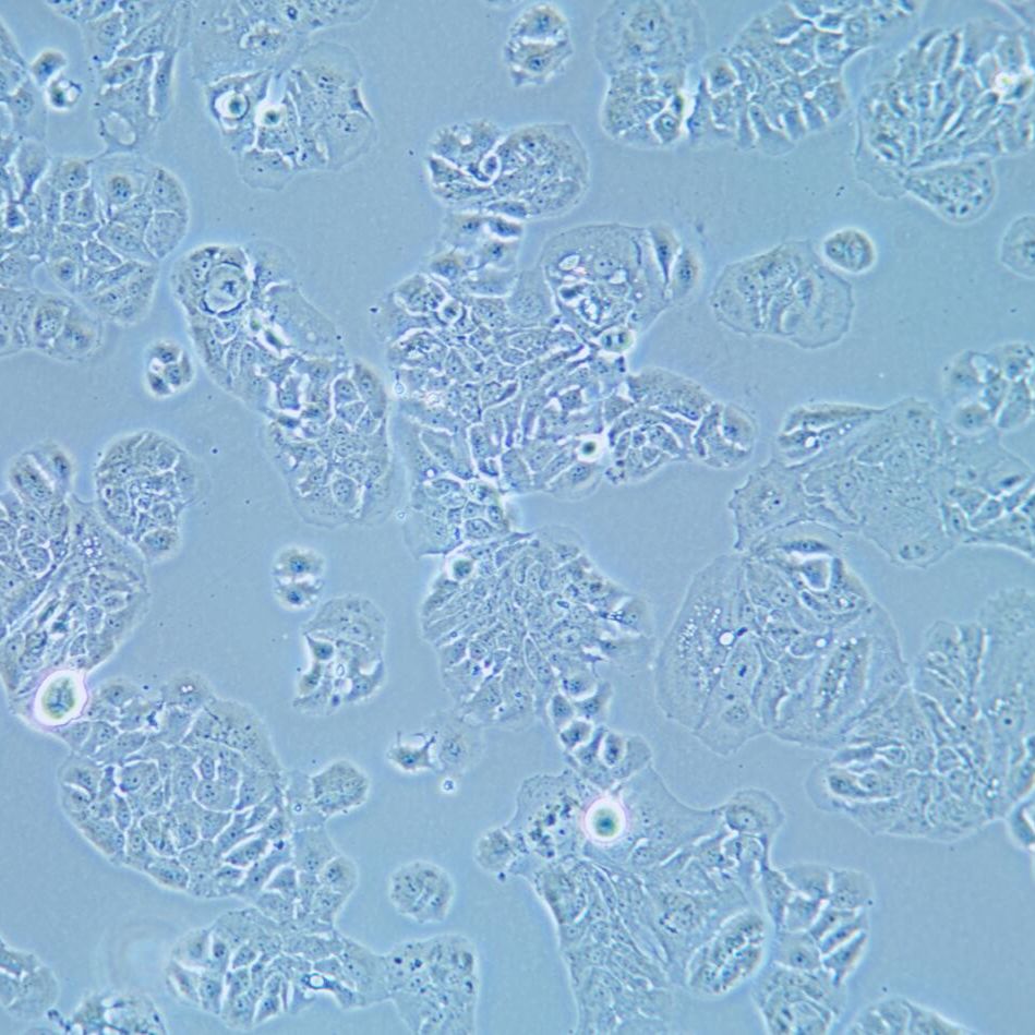 MDA-MB-415 人乳腺腺癌细胞/STR鉴定/镜像绮点（Cellverse）