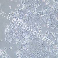 OE-33 人食管腺癌细胞/OE-33/OE-33细胞/OE33/OE33细胞/STR鉴定