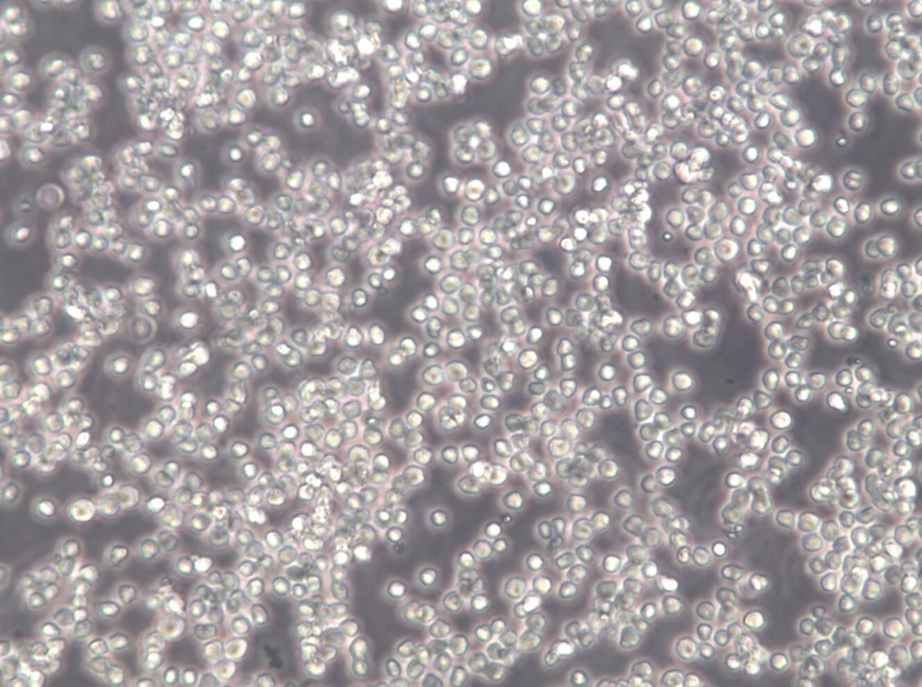 【STR鉴定】Sup-b15、Sup-b15细胞、Sup-b