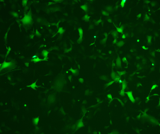 过表达慢病毒包装