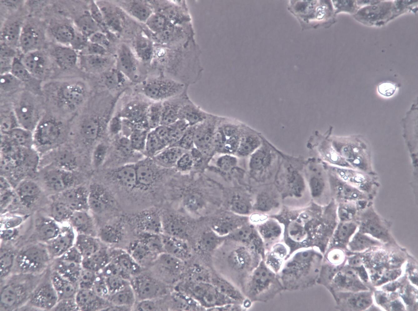 【STR鉴定】HUH-6、HUH-6细胞、HUH-6肝母细胞