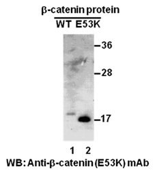 β-catenin (E53K)