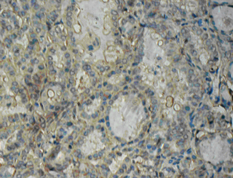 AKT1 Polyclonal Antibody
