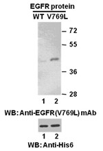 EGFR(V769L)