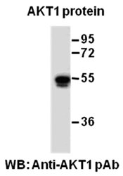 AKT1 Polyclonal Antibody