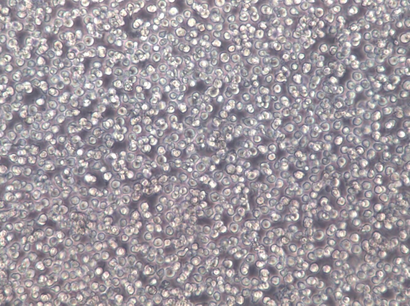 【STR鉴定】MV-4-11、MV-4-11细胞、MV-4-