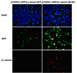 β-catenin (E53K)