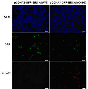 BRCA1(C61G)