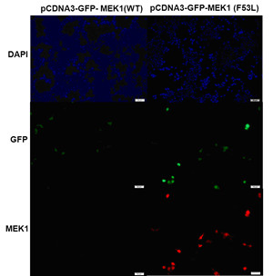 MEK1 (F53L)