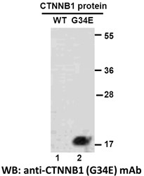 CTNNB1(G34E)