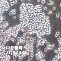 SUP-T1-GFP人T淋巴瘤细胞-绿色标记 