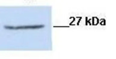CLIC1 antibody, N-term