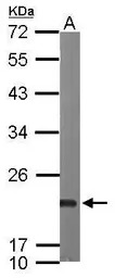 Sorcin antibody [N1C3]