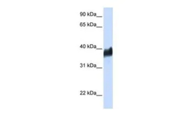 CLN8 antibody, N-term
