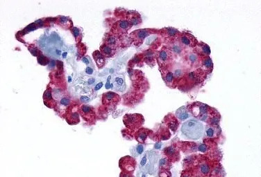 alpha 1d Adrenergic Receptor a