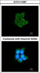 PFKM antibody [C1C3]