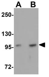 FREM2 antibody