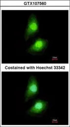 SKAP55 antibody [N1C3-2]