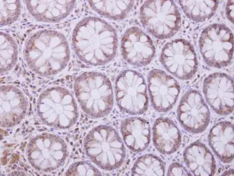 TRIM29 antibody [N3C3]