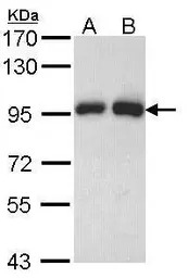 Gelsolin antibody