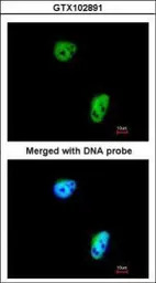 TLK1 antibody [N2C2], Internal