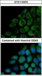 COG8 antibody [N3C3]