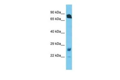 RHOT1 antibody, N-term