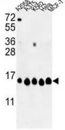 Histone H2A type 1H antibody, 