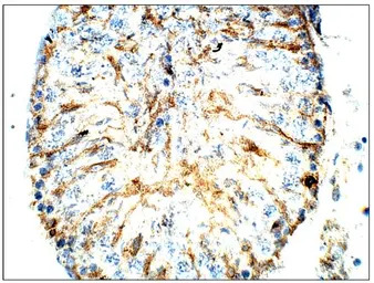 CD317 antibody (C-terminal)