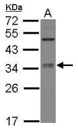 METTL6 antibody [N1C3]
