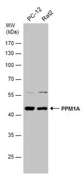PPM1A antibody