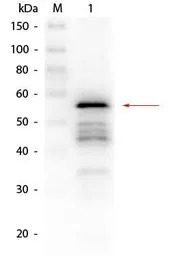 Aldehyde Dehydrogenase antibod