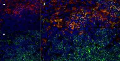 CD4 antibody [W3/25]