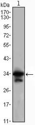 CDC2 antibody [8C5A6]