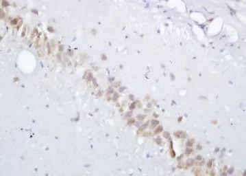 gamma Adaptin antibody