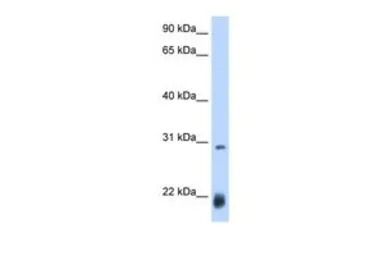 AC antibody, N-term