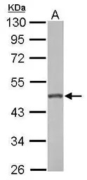 GALK2 antibody