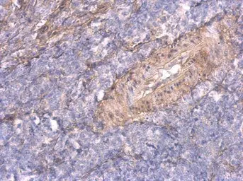 TNFAIP2 antibody [C1C3]