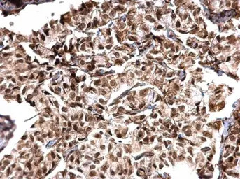 MTA1 antibody [C1C3]