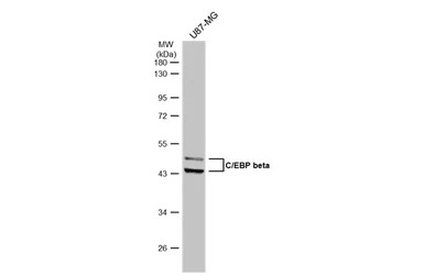 C/EBP beta antibody