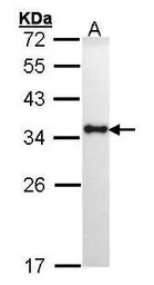 HLA-DRA antibody