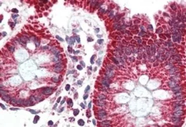 PBR antibody, C-term