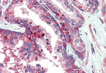 VPS35 antibody, C-term