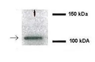 NEDD4L antibody, Internal
