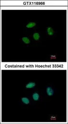 PHF6 antibody [N2C2], Internal